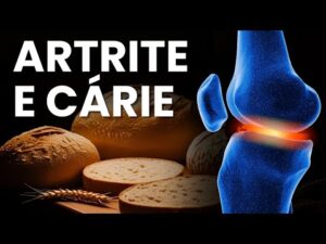 O que NÃO TE CONTAM sobre o TRIGO #glutenfree